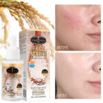 Rice Face Serum - Image 5